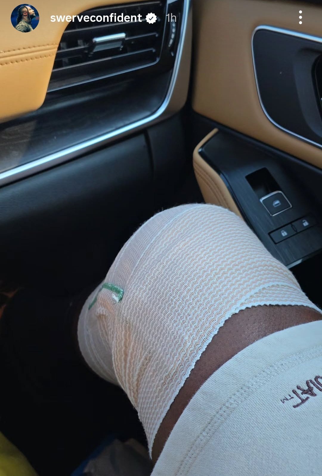 Swerve Strickland Undergoes Surgery 2