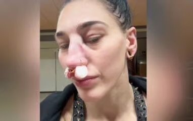 Rhea Ripley Injured At WWE Live Event In Japan